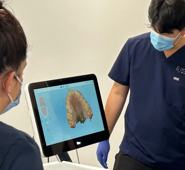 iTero 3D scanner