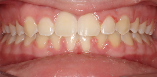 Before & Afters