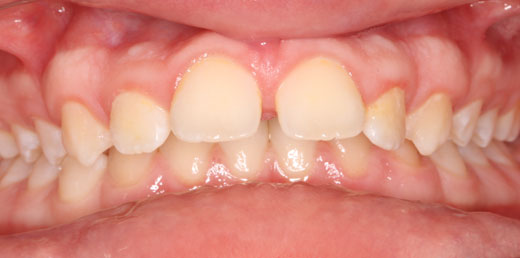Before & Afters