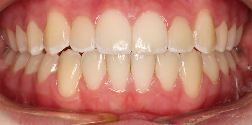 Before & Afters