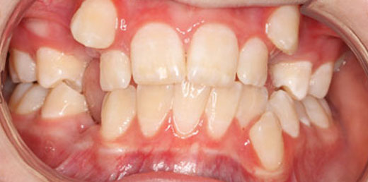 Before & Afters