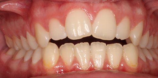 Before & Afters
