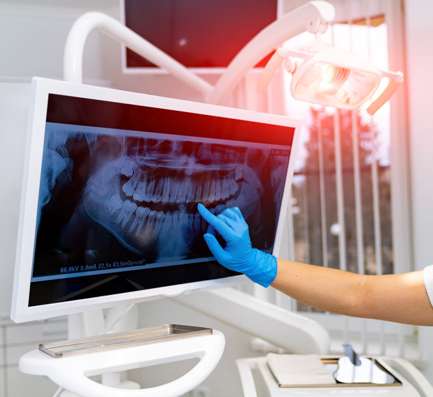 X-rays and dental photography