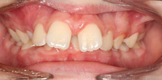 Before & Afters