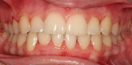 Before & Afters