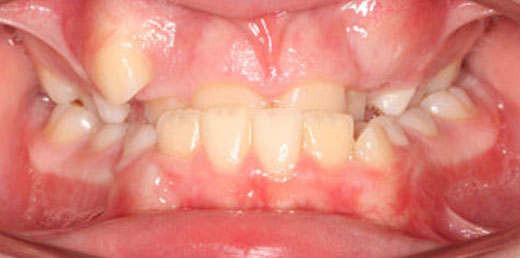 Before & Afters