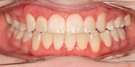 Before & Afters