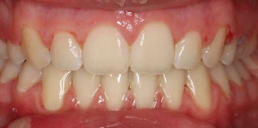 Before & Afters