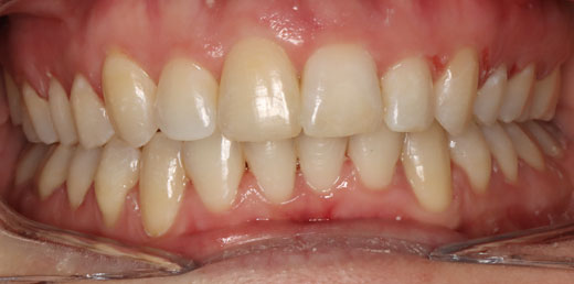 Before & Afters