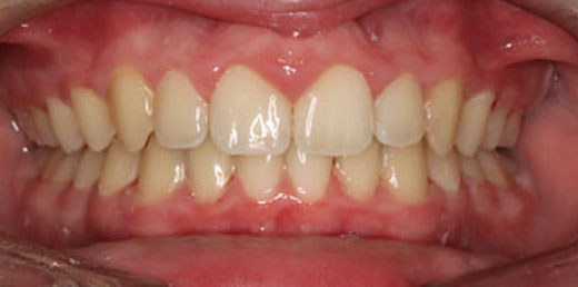 Before & Afters